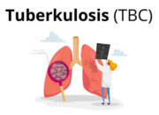 Keberhasilan Pengobatan TBC Di Sumut mencapai 90,2%