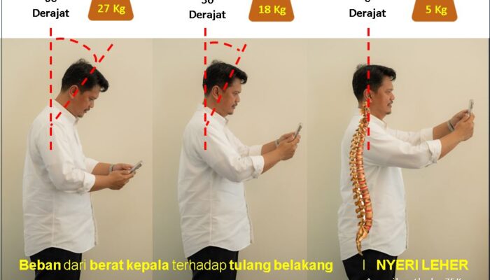 Rutin Gunakan Gadget, Para Seller Olshop Harus Perhatikan Ini Agar Tak Terkena Dampak Fatal