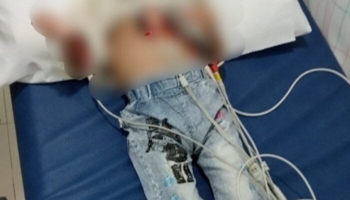 Bocah Abdya Bocor Jantung Butuh Uluran Tangan