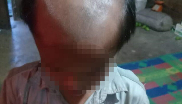 Guru Di Samosir Cukur Rambut Muridnya Jadi Botak Setengah