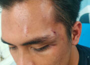 Anak Anggota DPRD Dairi Dikeroyok Di Sidikalang