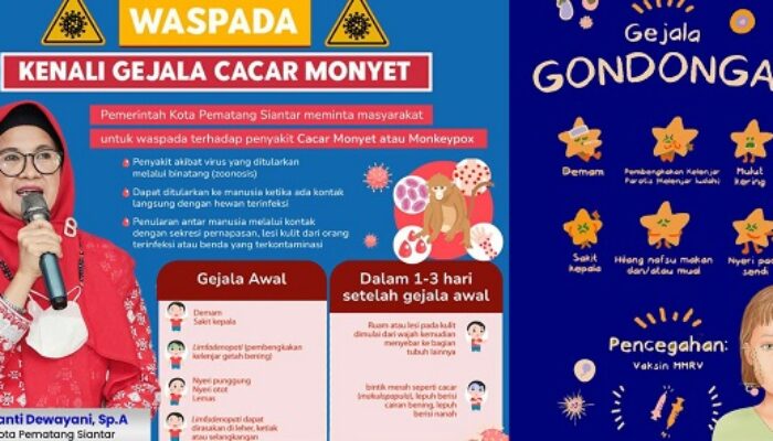 Gondongan Penyakit Menular Menyerang Anak Usia 2-12 Tahun