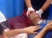 Bentrok Di Belawan Kambuh Lagi, 1 Kritis Tertembak