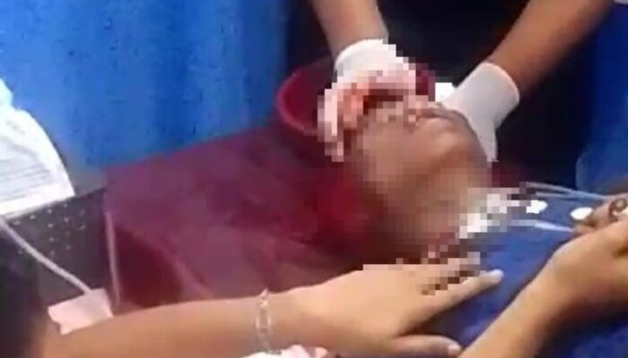 Bentrok Di Belawan Kambuh Lagi, 1 Kritis Tertembak