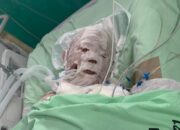 Korban Ledakan Gas Bumi PGN Akhirnya Meninggal Dunia