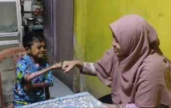 Dapat Perhatian Mensos, Remaja 17 Tahun Asal Seram Utara Penderita Kelainan Kulit Berobat ke RSCM