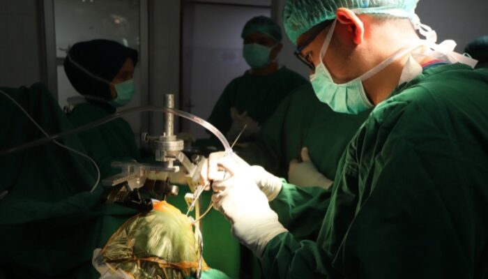 RS Adam Malik Berhasil Lakukan Operasi Stereotaktik Tumor Biopsi Perdana