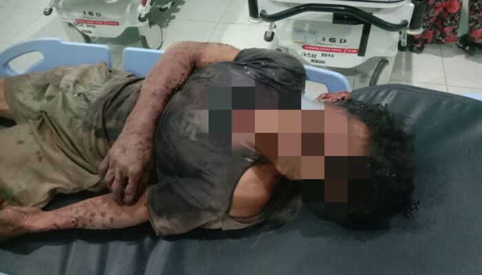 Perampok Sadis Beraksi Di Perbatasan Aceh, Korban Disiksa Uang Puluhan Juta Dikuras