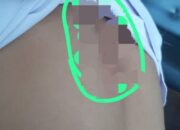 Santri Pesantren Darularafah Dianiaya, Orangtua Ngadu Ke Polrestabes Medan