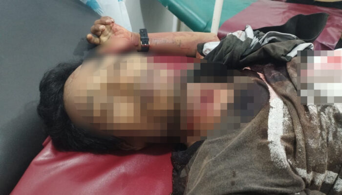 Dikeroyok Dua, Barus Tewas Dengan Tusukan Di Leher