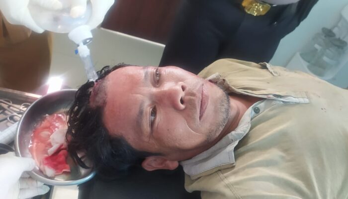 Sedang Duduk Di Warung, Pria 50 Tahun Ditembak OTK Di Tigarunggu