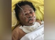 Ibu Rumahtangga Dibakar Hidup-hidup Di Medan Estate