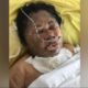 HERLINDA Boru Gurusinga, 53, menjalani perawatan di Jl. RS Haji, Desa Medan Estate, Kecamatan Percut Seituan, Kabupaten Deliserdang, Senin (13/5), setelah dibakar oleh pria berinisial SP alias Leman, 51. Waspasa/ist