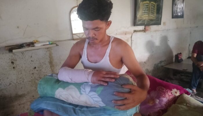 Tangan Ridho Nyaris Putus Dibegal