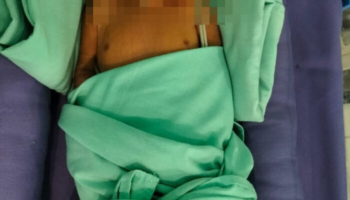 Kondisi Bayi Ditemukan Di Masjid Lewati Masa Krisis