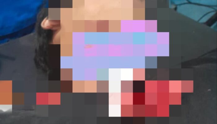 Seorang Pemuda Digorok Saat Ngopi