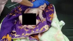 Bayi malang saat dibawa ke rumah sakit Parapat.(Waspada/ist).
