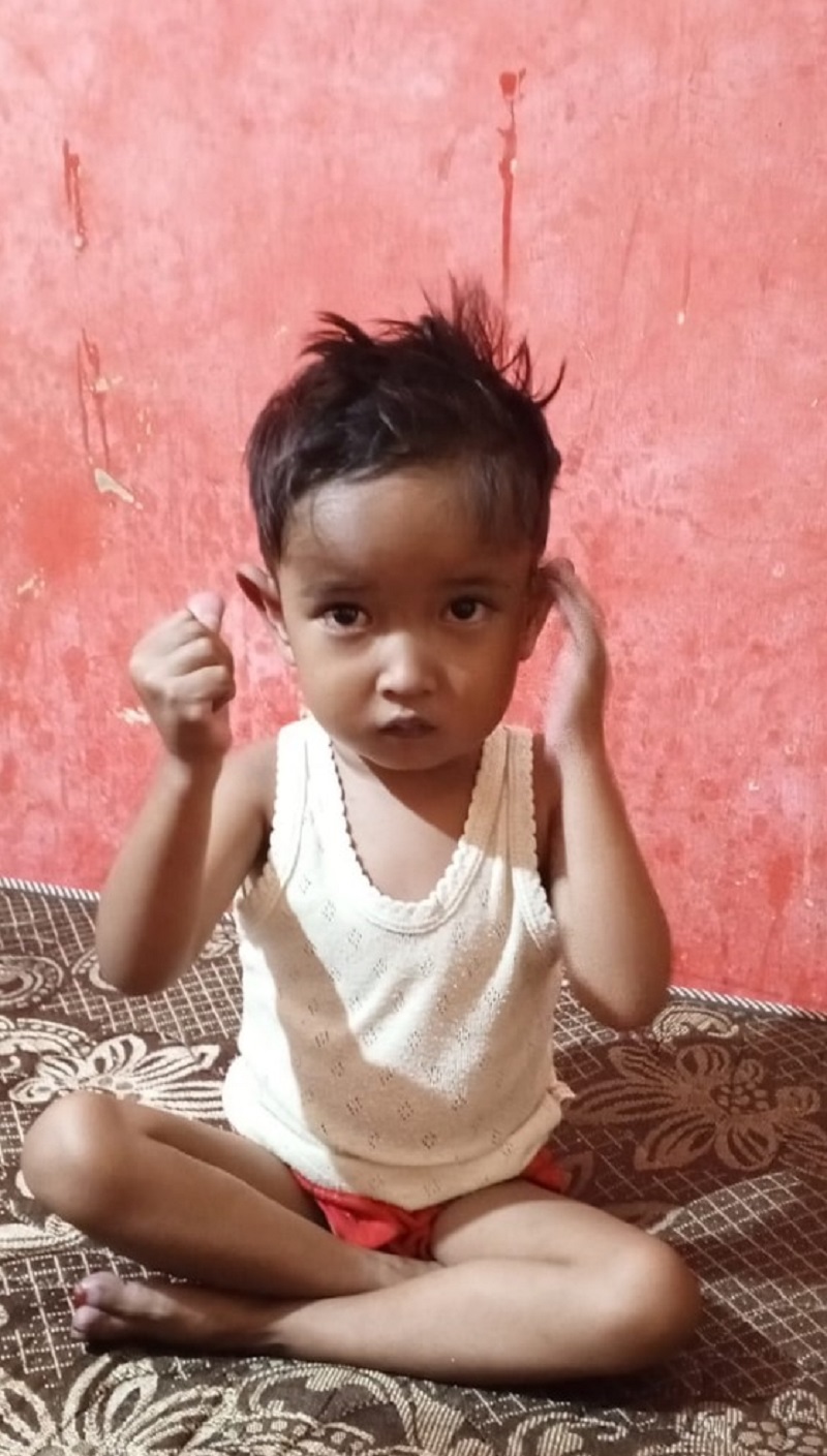 Khairul Nazmi, bocah laki-laki usia 4 tahun, buah pasangan Hamdan dan Harnita, warga Desa Alue Raya, Kecamatan Darul Makmur, Kabupaten Nagan Raya, penderita bocor jantung yang butuh uluran tangan dermawan. Jumat (26/7).Waspada/Syafrizal