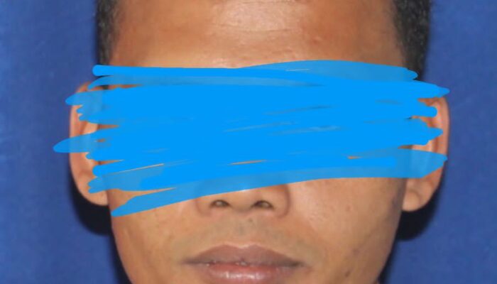 Gegara Rp50 Ribu, Suami Bunuh Istri Di Aceh Tenggara