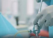 Proses Sedot Lemak, Solusi Instan Dengan Risiko Yang Perlu Diketahui