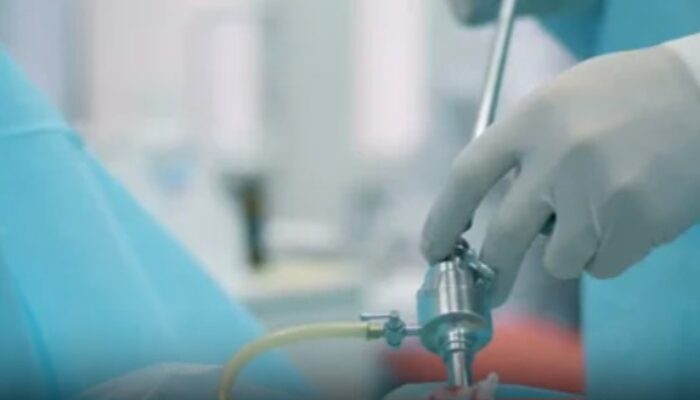 Proses Sedot Lemak, Solusi Instan Dengan Risiko Yang Perlu Diketahui