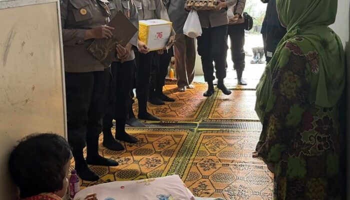 Sambut Hari Jadi, Polwan Polres P.Siantar Kunjungi Penderita Hidrosefalus