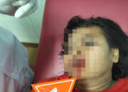 Pekerja Cafe Di Bilah Barat Dibacok