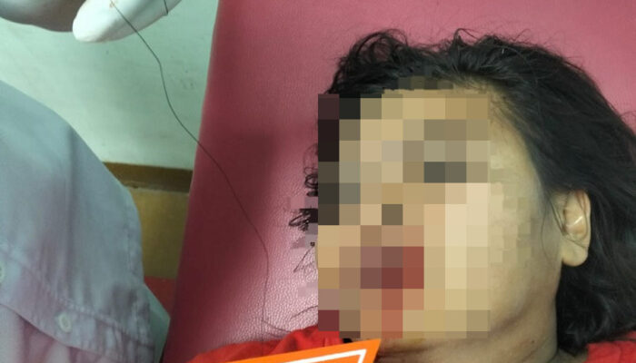 Pekerja Cafe Di Bilah Barat Dibacok