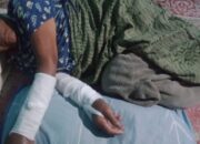 Tendangan Anak Durhaka Membuat Kedua Tangan Sang Ibu Renta Patah