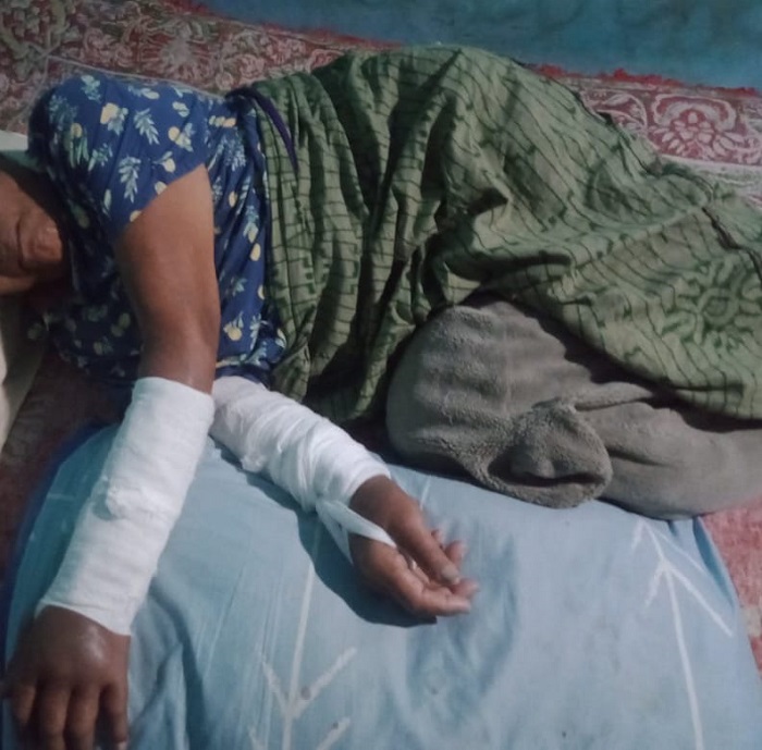 INILAH kondisi ibu yang menjadi sasaran keberutalan anak yang dibagikan oleh menantu korban. Waspada/Ist
