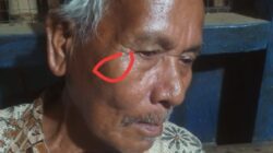 Yahya, 70, guru balai pengajian Al Munawarah Gampong Punti, Minggu (22/9), menunjukkan foto wajahnya memar setelah ditinju Ketua Tuha Peut Gampong Punti Kec. Syamtalira Bayu Kab. Aceh Utara. Waspada/Zainuddin. Abdullah