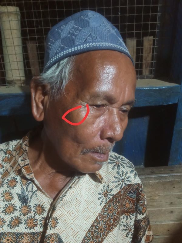 Yahya, 70, guru balai pengajian Al Munawarah Gampong Punti, Minggu (22/9), menunjukkan foto wajahnya memar setelah ditinju Ketua Tuha Peut Gampong Punti Kec. Syamtalira Bayu Kab. Aceh Utara. Waspada/Zainuddin. Abdullah