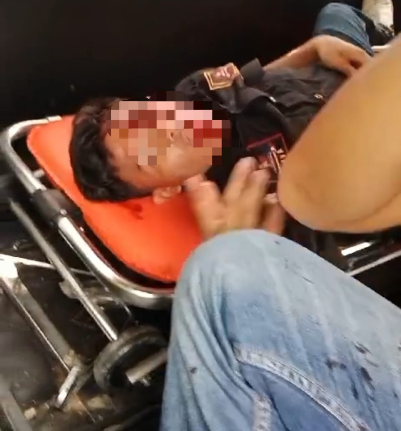 SEORANG anggota Ormas menderita luka akibat lemparan batu setelah diserang oleh sekelompok orang diduga kawan geng motor di Jl. Gatot Subroto depan Lotte Mart Kelurahan Lalang Kecamatan Medan Sunggal, Minggu (13/10). Waspada/Ist