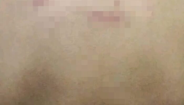 Ayah Santri Korban Tindakan Kekerasan Di Agara: Saya Sudah Lapor Ke Polres Agara