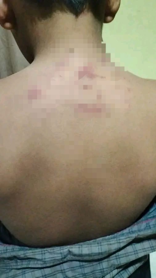 Ayah Santri Korban Tindakan Kekerasan Di Agara: Saya Sudah Lapor Ke Polres Agara