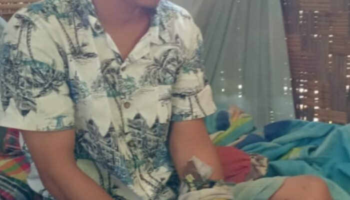 Tangan Korban Remuk, Pelaku Belum Ditahan