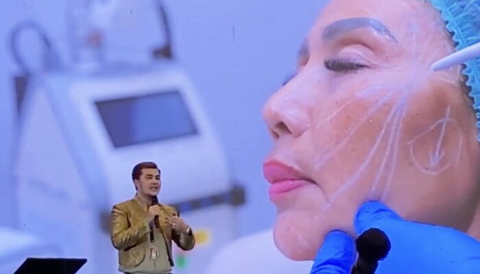 Kombinasi Thread Lift Dan Derma Filler, Tren Kecantikan Di IndAAC Sumut 2025