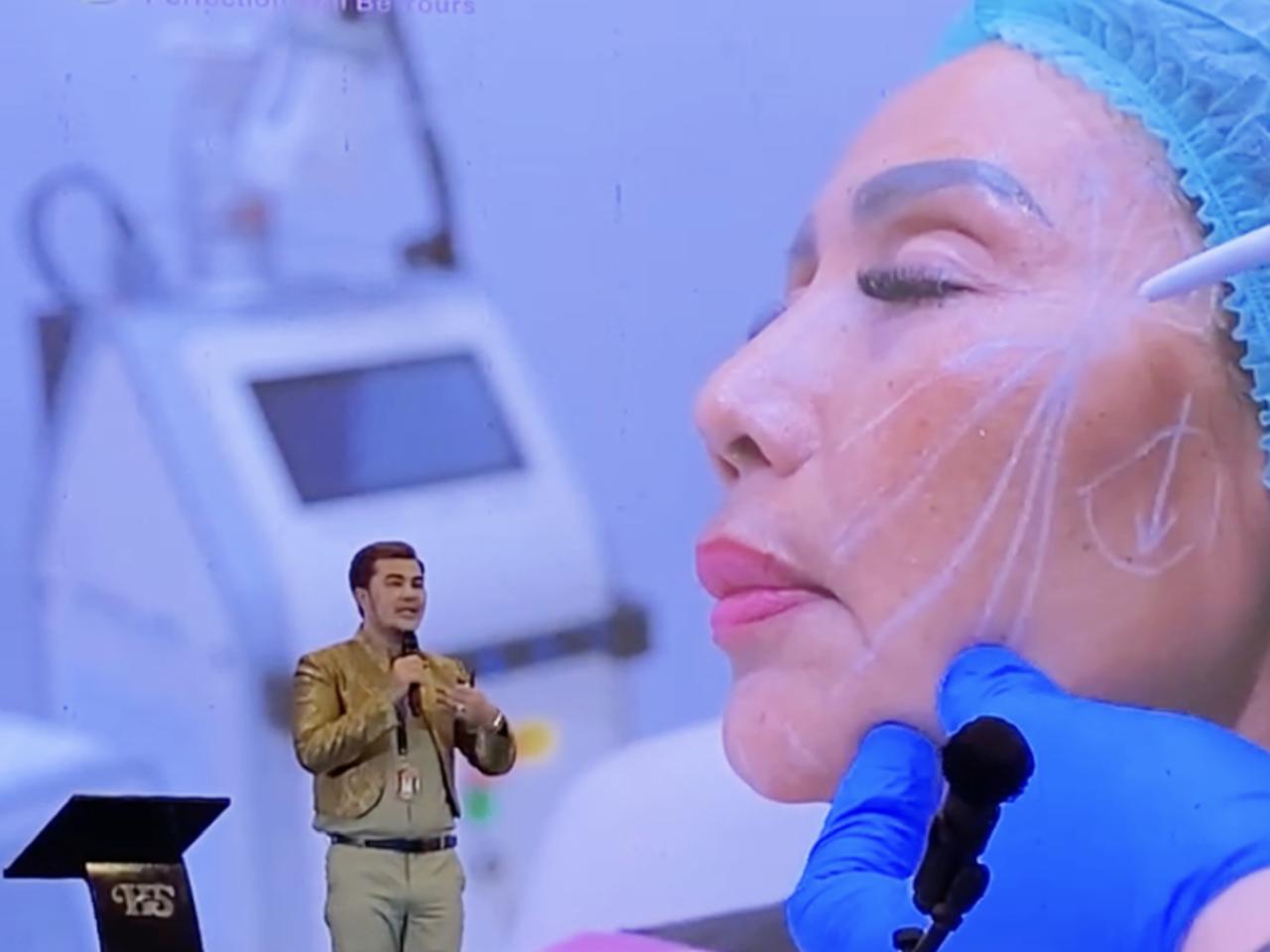 Kombinasi Thread Lift Dan Derma Filler, Tren Kecantikan Di IndAAC Sumut 2025