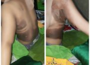 Sekdes Di Sidimpuan Bakar Teman Wanita Karena Cemburu