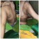 Wanita korban aksi pembakaran yang dilakukan oknum Sekdes di Padangsidimpuan. (Waspada/Ist)
