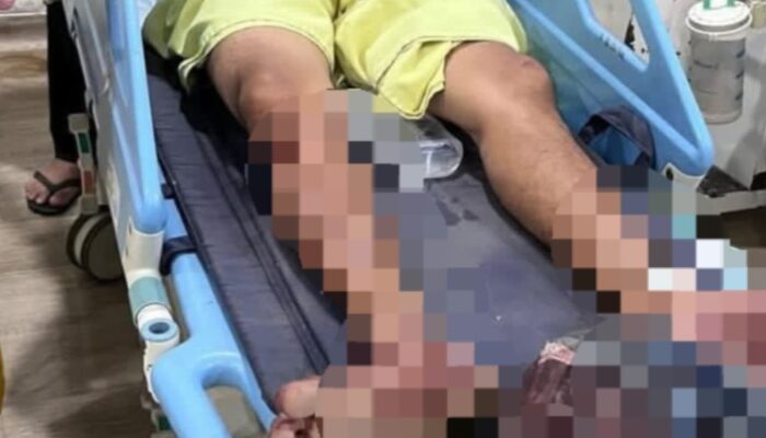 Diduga Persaingan Bisnis, Pengedar Narkoba Saling Bacok Di Deliserdang