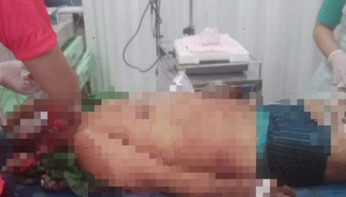 Driver Ojol Tewas Di Jalan Gaperta