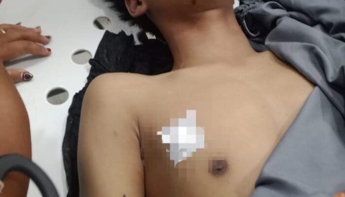 Tawuran Kembali Terjadi Di Gudang Arang Belawan, 1 Tewas