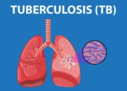 Tuberkulosis Di Sumut Capai 18.411 Kasus, Dinkes Sumut Dorong Perilaku Hidup Bersih dan Sehat