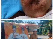 Alumni Ponpes Daar Al Uluum Asahan Bantu Anak Pengidap Tumor Di Mulut