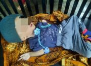 Balita Penderita Hidrosefalus Di Tapsel Butuh Bantuan