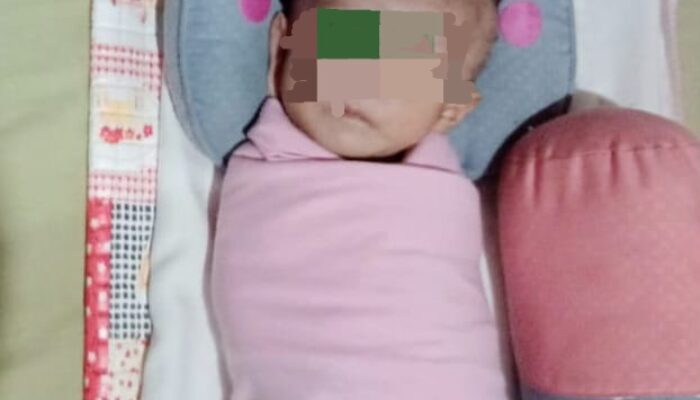 Bayi Bocor Jantung Di Abdya Butuh Uluran Tangan Dermawan