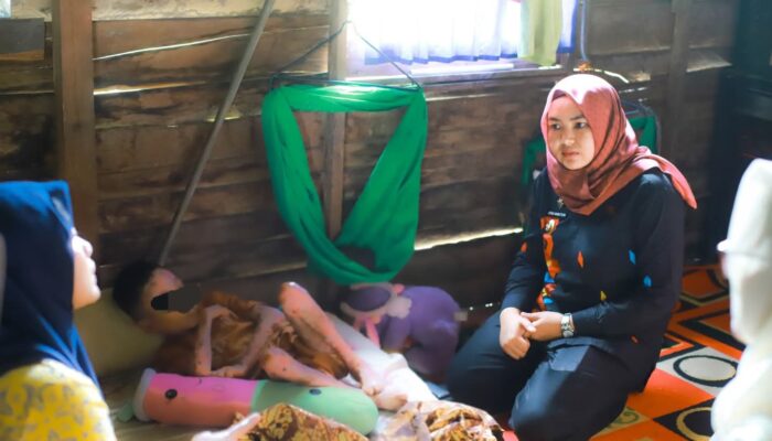 Wabup Madina Jenguk Anak Kelainan Genetik