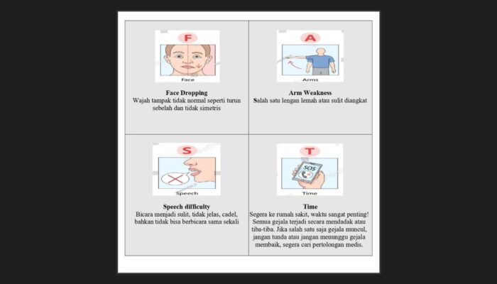 Deteksi Stroke dengan FAST