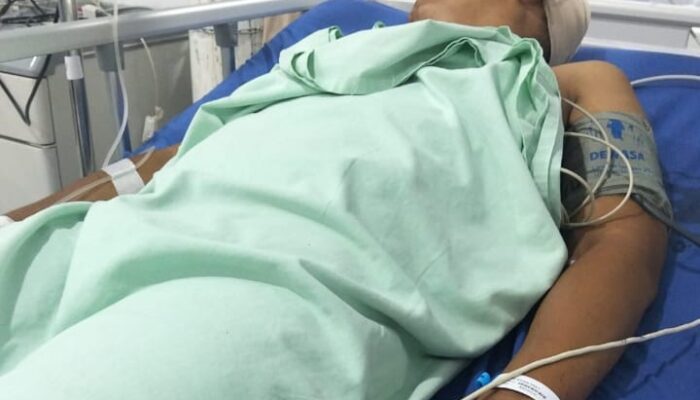Sebulan Lebih Jalani Perawatan, Korban Pembacokan Akhirnya Meninggal Dunia